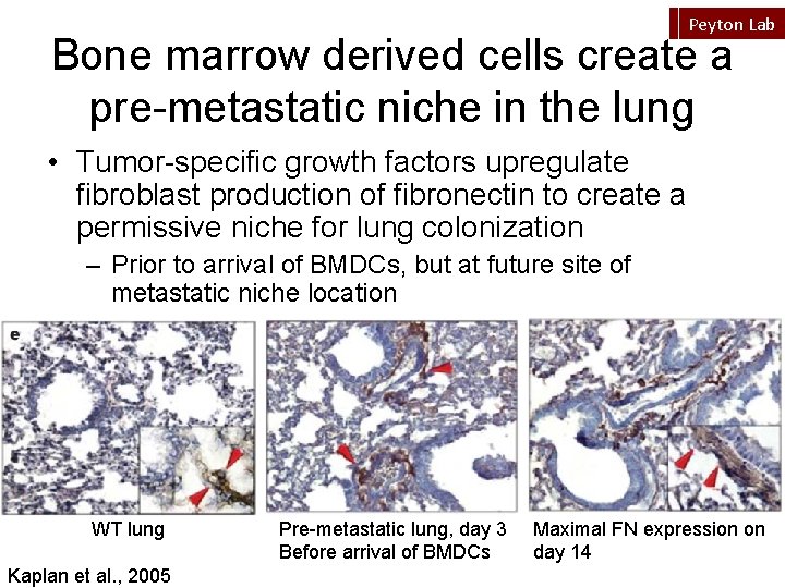 Peyton Lab Bone marrow derived cells create a pre-metastatic niche in the lung •