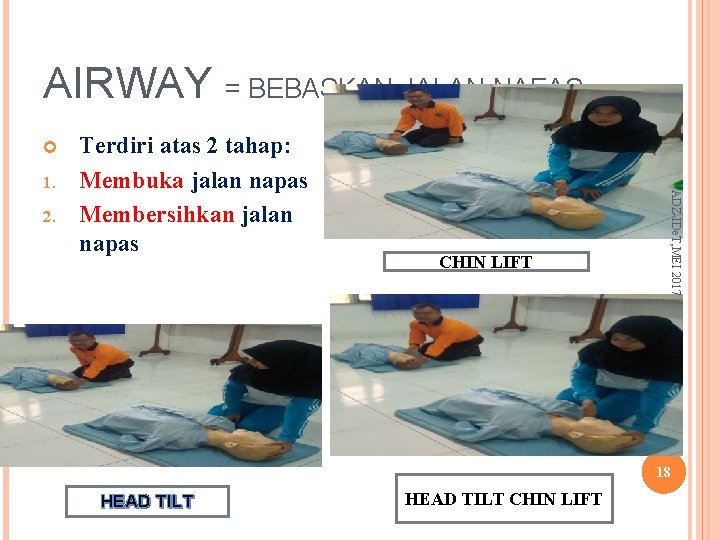 AIRWAY = BEBASKAN JALAN NAFAS 2. CHIN LIFT ADZ-IDe. T, MEI 2017 1. Terdiri