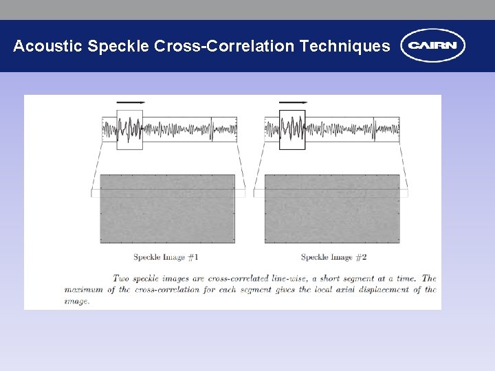 Acoustic Speckle Cross-Correlation Techniques 