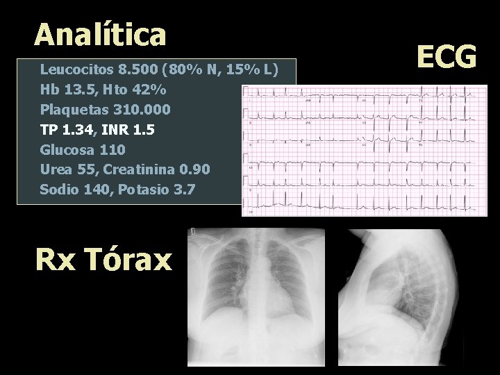 Analítica Leucocitos 8. 500 (80% N, 15% L) Hb 13. 5, Hto 42% Plaquetas