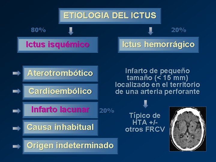 ETIOLOGIA DEL ICTUS 80% 20% Ictus isquémico Ictus hemorrágico Infarto de pequeño tamaño (<