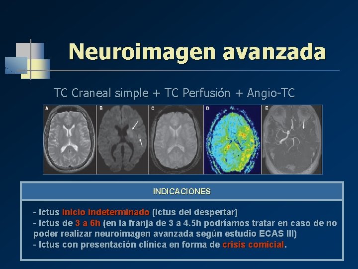 Neuroimagen avanzada TC Craneal simple + TC Perfusión + Angio-TC INDICACIONES - Ictus inicio