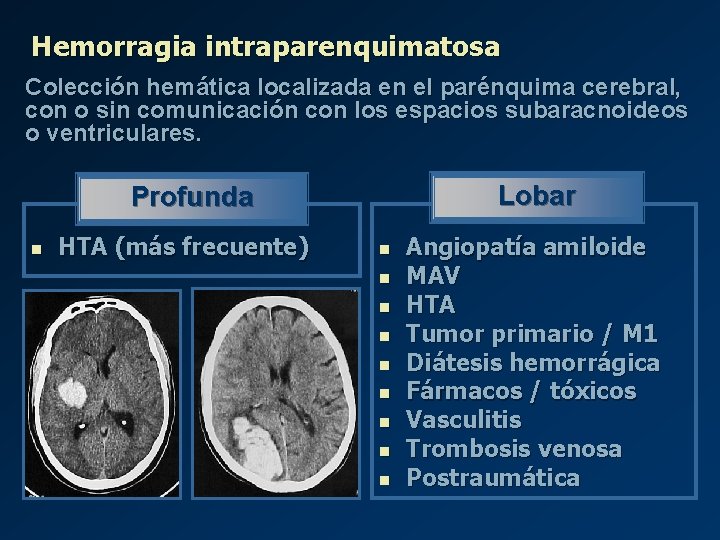 Hemorragia intraparenquimatosa Colección hemática localizada en el parénquima cerebral, con o sin comunicación con