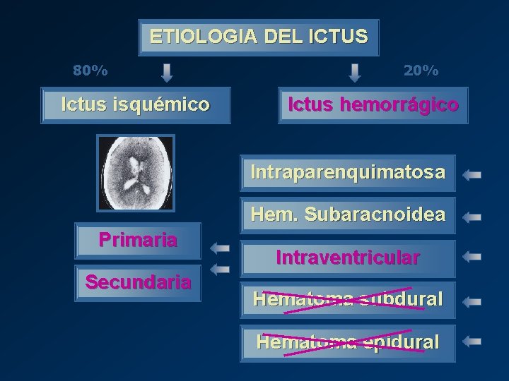 ETIOLOGIA DEL ICTUS 80% Ictus isquémico 20% Ictus hemorrágico Intraparenquimatosa Hem. Subaracnoidea Primaria Secundaria