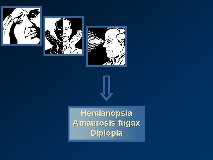 Hemianopsia Amaurosis fugax Diplopia 