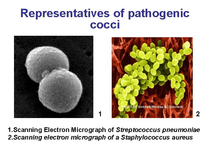 Representatives of pathogenic cocci 1 2 1. Scanning Electron Micrograph of Streptococcus pneumoniae 2.