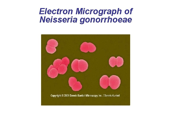 Electron Micrograph of Neisseria gonorrhoeae 