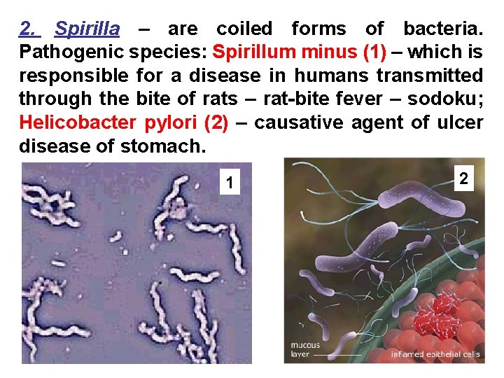 2. Spirilla – are coiled forms of bacteria. Pathogenic species: Spirillum minus (1) –