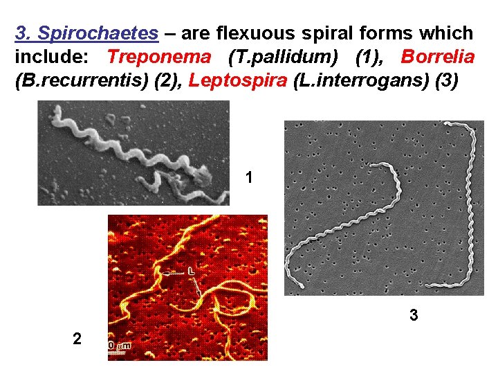 3. Spirochaetes – are flexuous spiral forms which include: Treponema (T. pallidum) (1), Borrelia