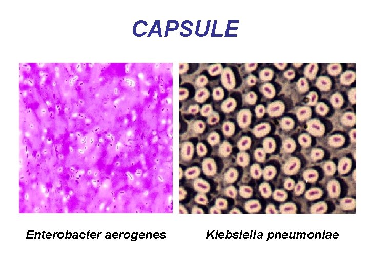 CAPSULE Enterobacter aerogenes Klebsiella pneumoniae 