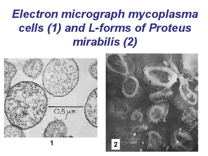 Electron micrograph mycoplasma cells (1) and L-forms of Proteus mirabilis (2) 1 2 