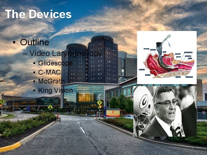 The Devices • Outline – Video Laryngoscopy • • Glidescope C-MAC Mc. Grath King