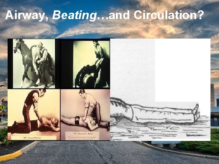 Airway, Beating…and Circulation? 