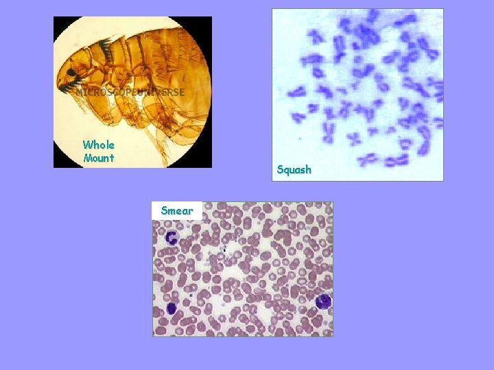 Whole Mount Squash Smear 