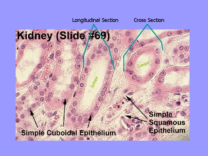 Longitudinal Section Cross Section lum en en m u l 