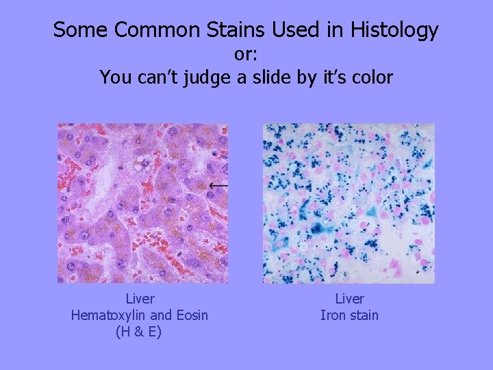 Some Common Stains Used in Histology or: You can’t judge a slide by it’s