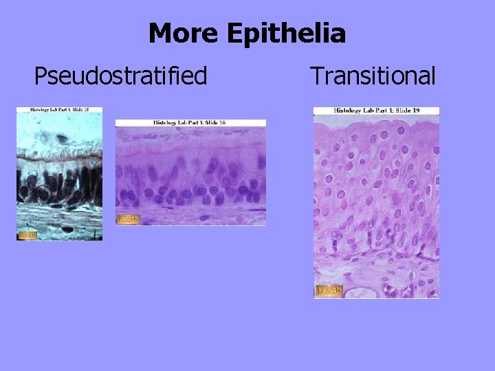 More Epithelia Pseudostratified Transitional 