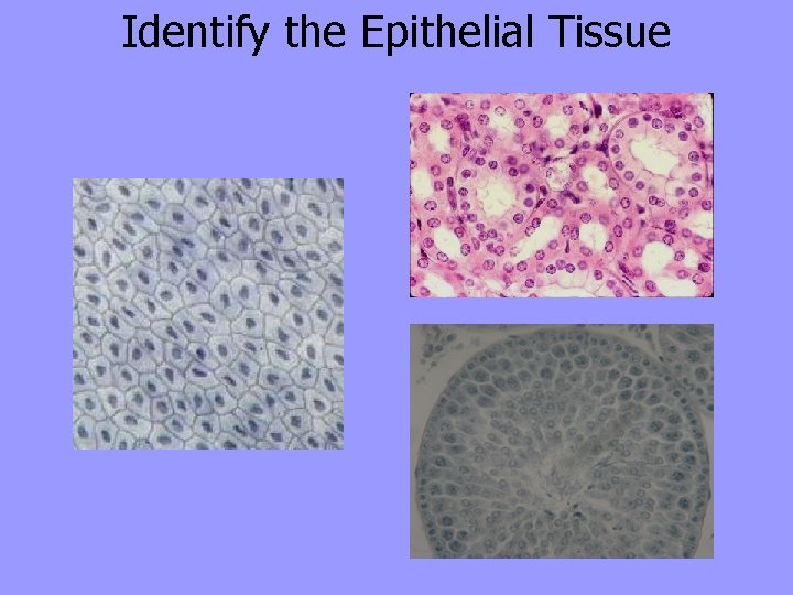 Identify the Epithelial Tissue 