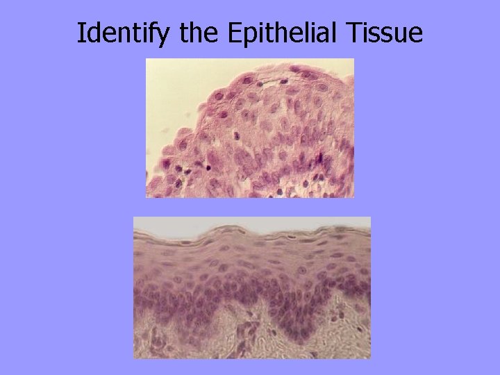 Identify the Epithelial Tissue 