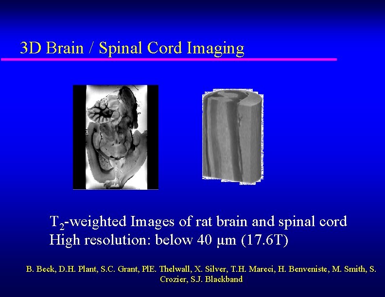 3 D Brain / Spinal Cord Imaging T 2 -weighted Images of rat brain