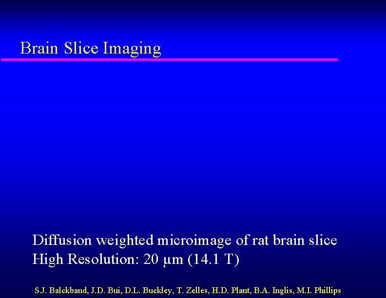 Brain Slice Imaging Diffusion weighted microimage of rat brain slice High Resolution: 20 µm
