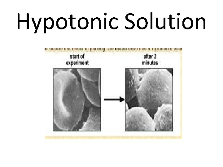 Hypotonic Solution 