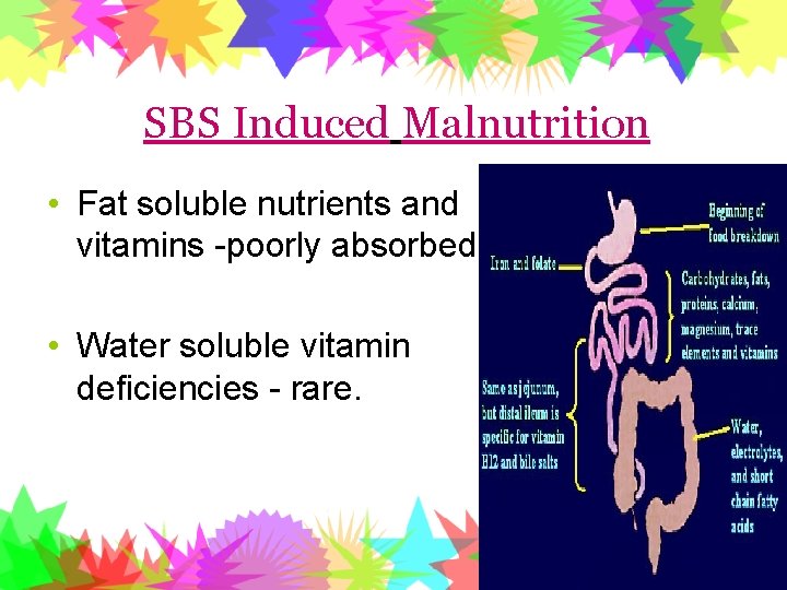 SBS Induced Malnutrition • Fat soluble nutrients and vitamins -poorly absorbed • Water soluble