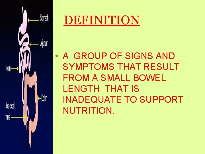 DEFINITION • A GROUP OF SIGNS AND SYMPTOMS THAT RESULT FROM A SMALL BOWEL