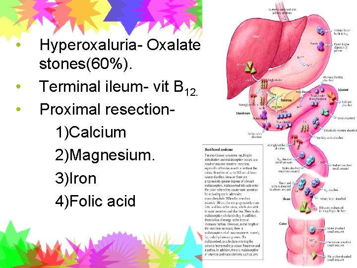  • • • Hyperoxaluria- Oxalate stones(60%). Terminal ileum- vit B 12. Proximal resection