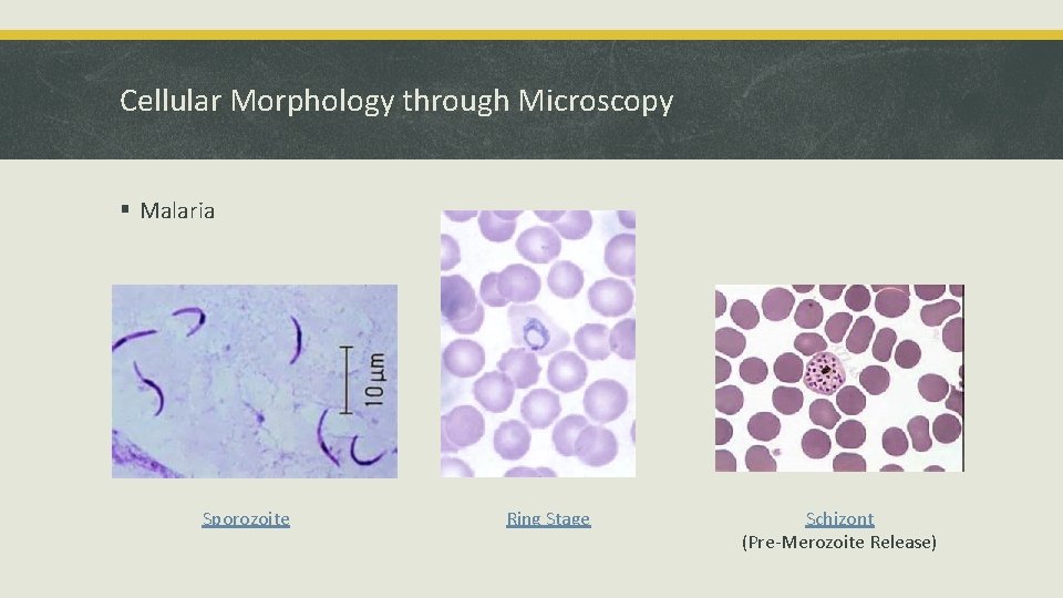 Cellular Morphology through Microscopy § Malaria Sporozoite Ring Stage Schizont (Pre-Merozoite Release) 
