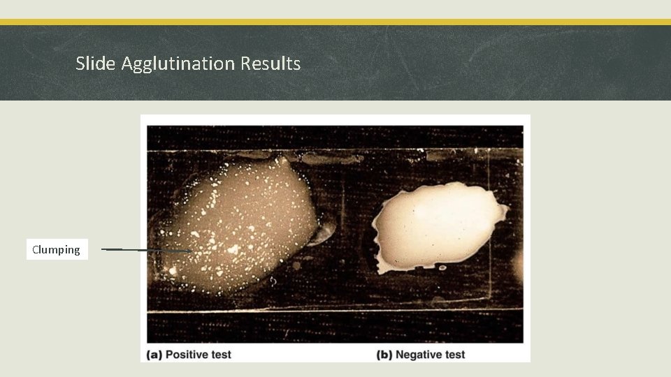 Slide Agglutination Results Clumping 