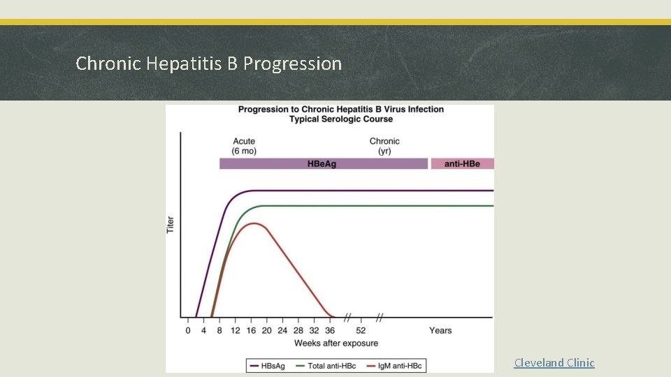 Chronic Hepatitis B Progression Cleveland Clinic 