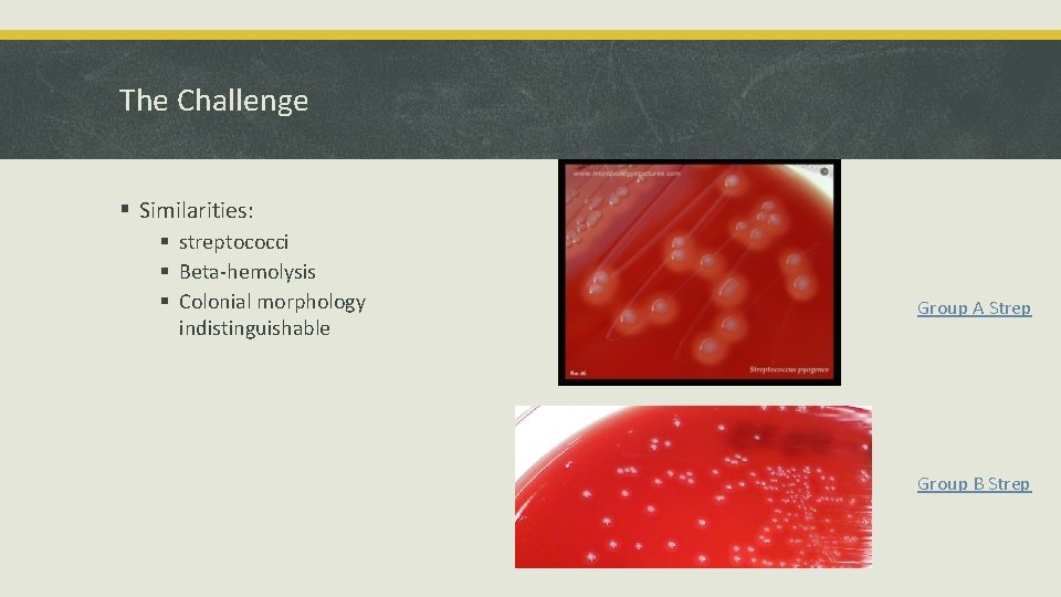 The Challenge § Similarities: § streptococci § Beta-hemolysis § Colonial morphology indistinguishable Group A