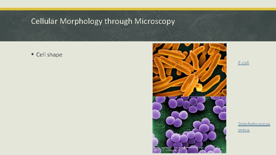 Cellular Morphology through Microscopy § Cell shape E. coli Staphylococcus areus 