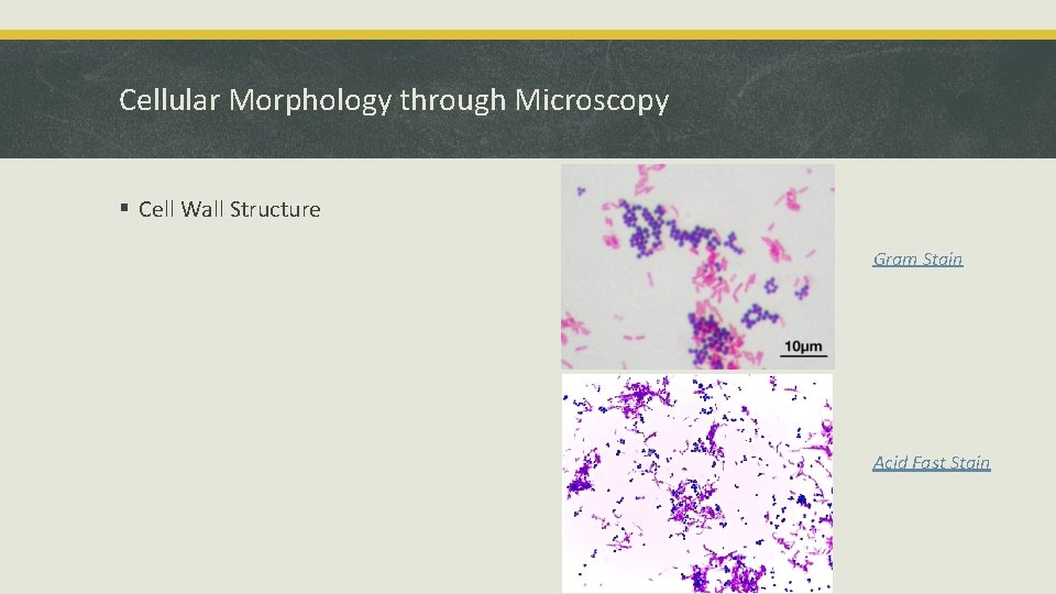 Cellular Morphology through Microscopy § Cell Wall Structure Gram Stain Acid Fast Stain 