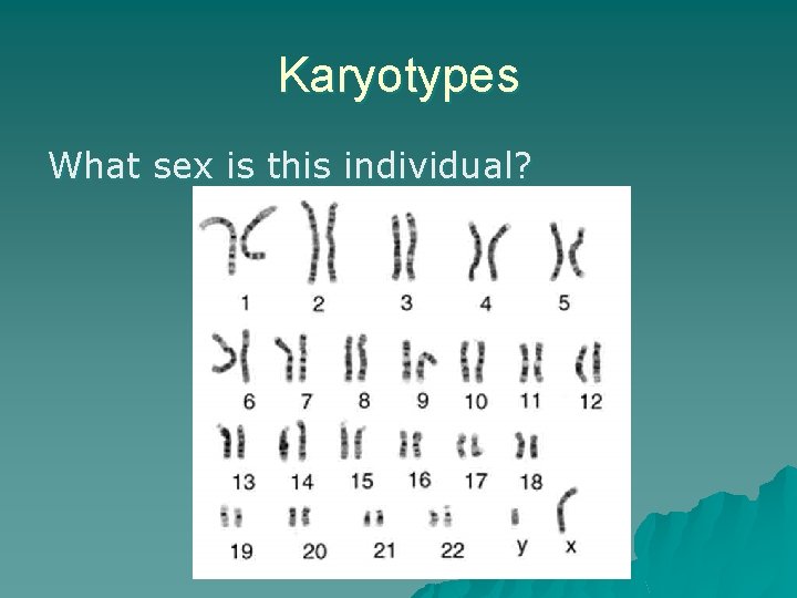 Karyotypes What sex is this individual? 