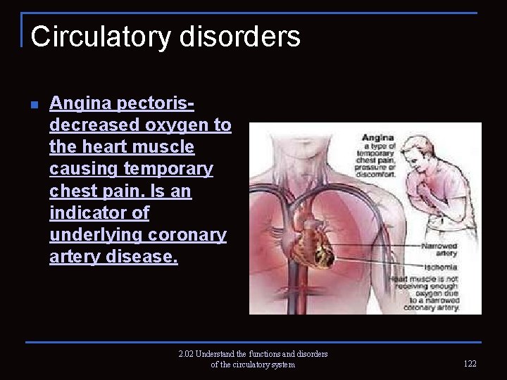 Circulatory disorders n Angina pectoris- decreased oxygen to the heart muscle causing temporary chest