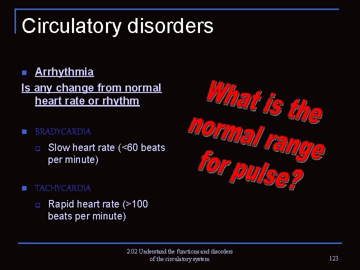 Circulatory disorders Arrhythmia Is any change from normal heart rate or rhythm n n