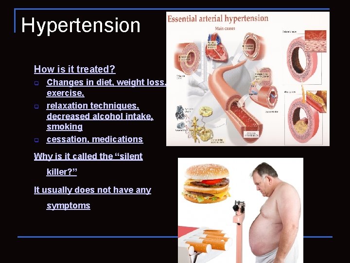 Hypertension How is it treated? q q q Changes in diet, weight loss, exercise,