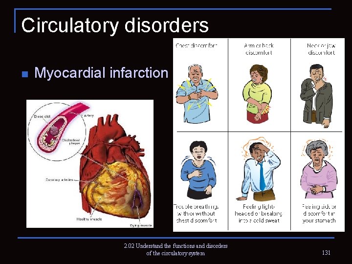Circulatory disorders n Myocardial infarction 2. 02 Understand the functions and disorders of the