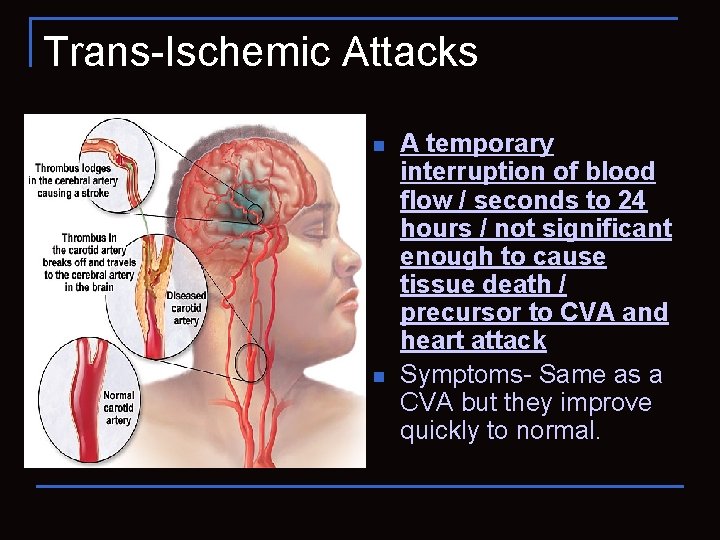 Trans-Ischemic Attacks n n A temporary interruption of blood flow / seconds to 24