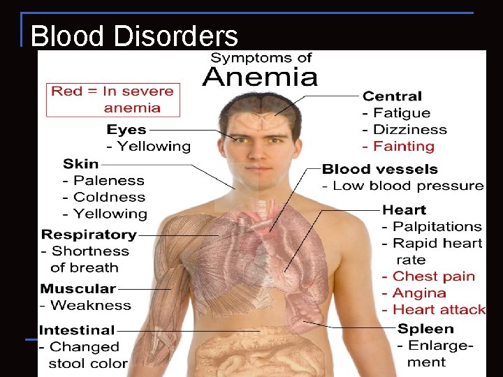 Blood Disorders 50 