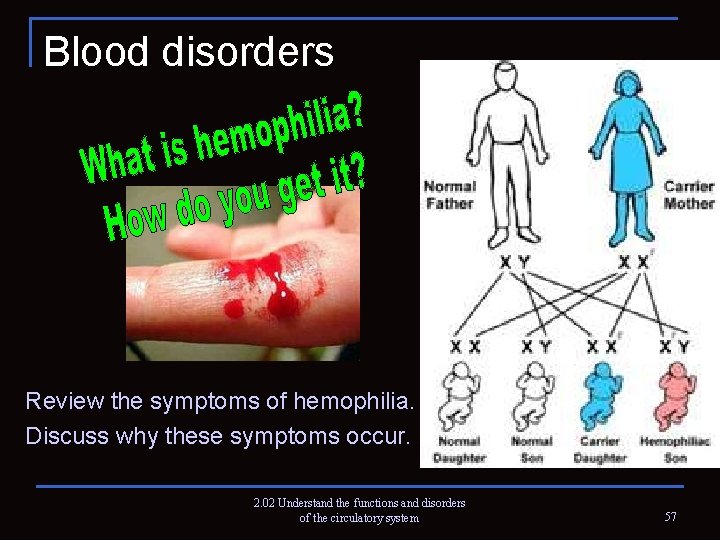 Blood disorders Review the symptoms of hemophilia. Discuss why these symptoms occur. 2. 02