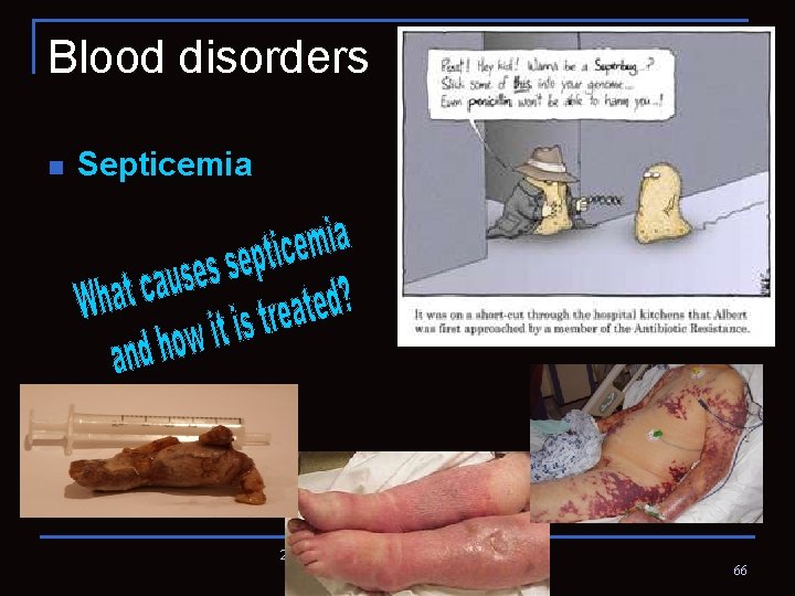 Blood disorders n Septicemia 2. 02 Understand the functions and disorders of the circulatory