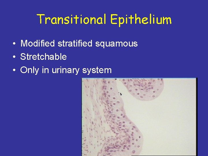 Transitional Epithelium • Modified stratified squamous • Stretchable • Only in urinary system 