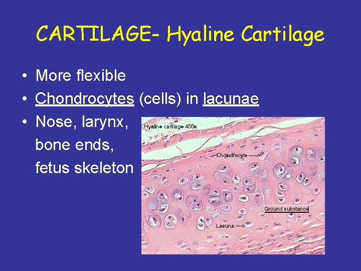 CARTILAGE- Hyaline Cartilage • More flexible • Chondrocytes (cells) in lacunae • Nose, larynx,