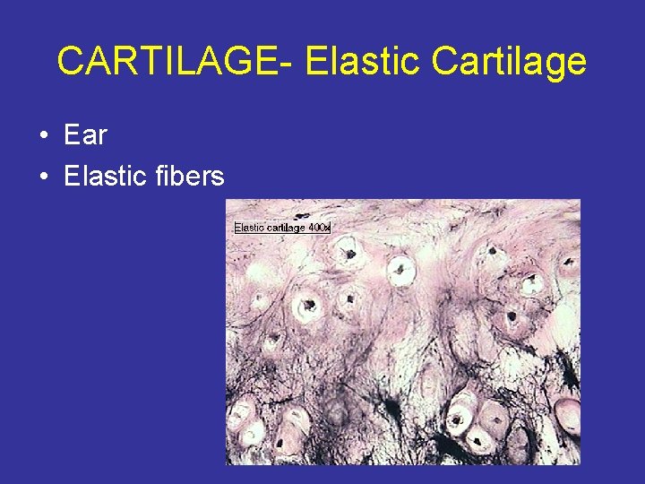 CARTILAGE- Elastic Cartilage • Ear • Elastic fibers 