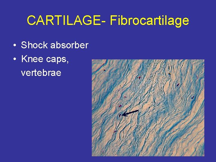 CARTILAGE- Fibrocartilage • Shock absorber • Knee caps, vertebrae 