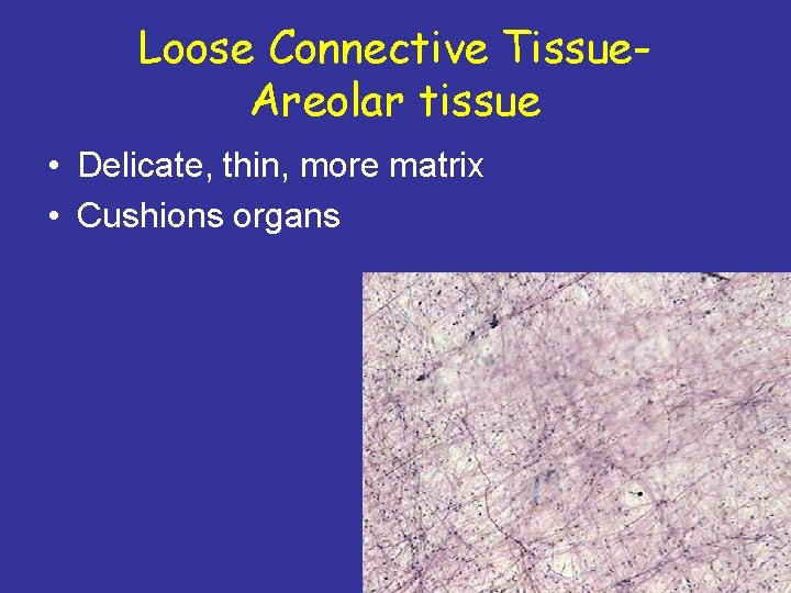 Loose Connective Tissue. Areolar tissue • Delicate, thin, more matrix • Cushions organs 