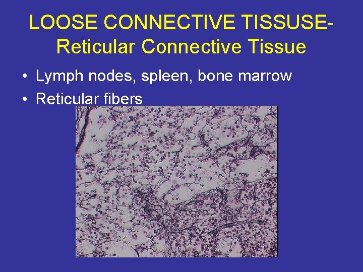 LOOSE CONNECTIVE TISSUSEReticular Connective Tissue • Lymph nodes, spleen, bone marrow • Reticular fibers